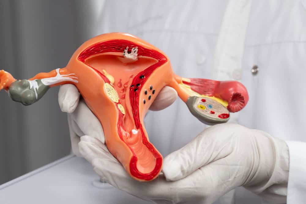 How Uterine Transplantation Can Help Women Without a Functional Uterus?