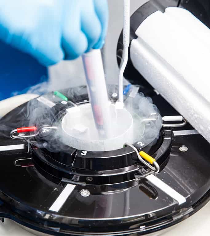 How Environmental Factors in Delhi-NCR Affect Sperm Quality and What You Can Do About It
