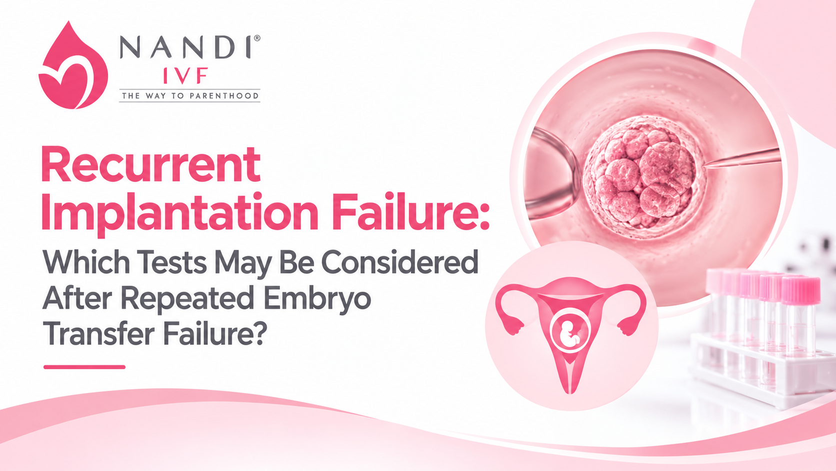 Recurrent Implantation Failure: Which Tests May Be Considered After Repeated Embryo Transfer Failure?