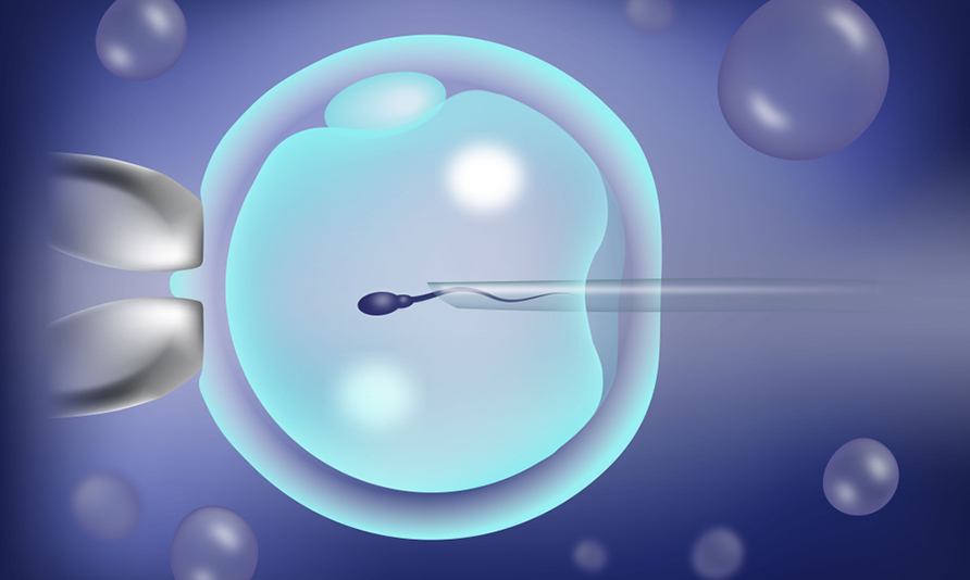 intracytoplasmic sperm injection