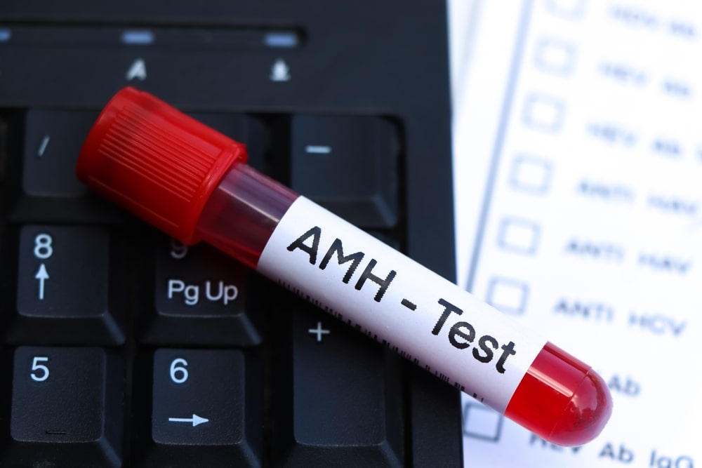 AMH Test Price In Delhi