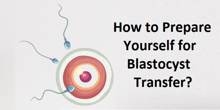 How to Prepare Yourself for Blastocyst Transfer