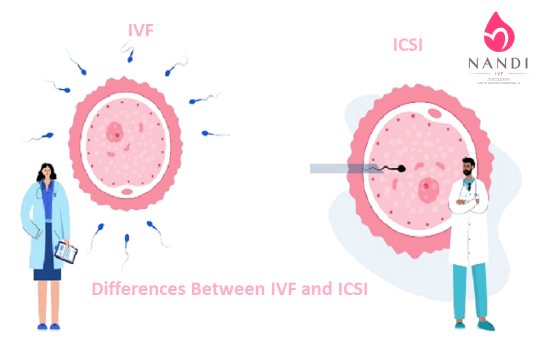 Difference Between IVF and ICSI