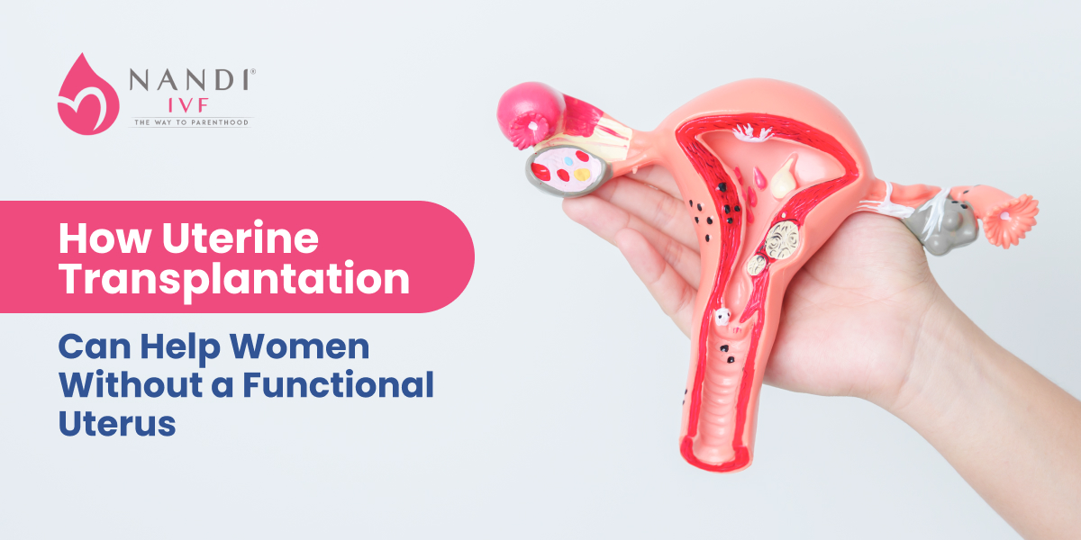 Uterine Transplantation for Women