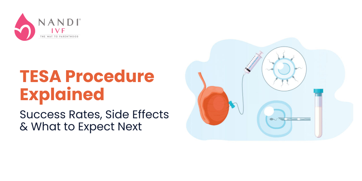 TESA Procedure Explained