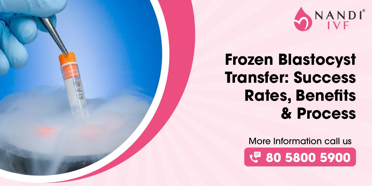 Frozen Blastocyst Transfer